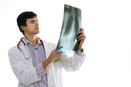 doctor with x-ray, pneumonia, signs of pneumonia