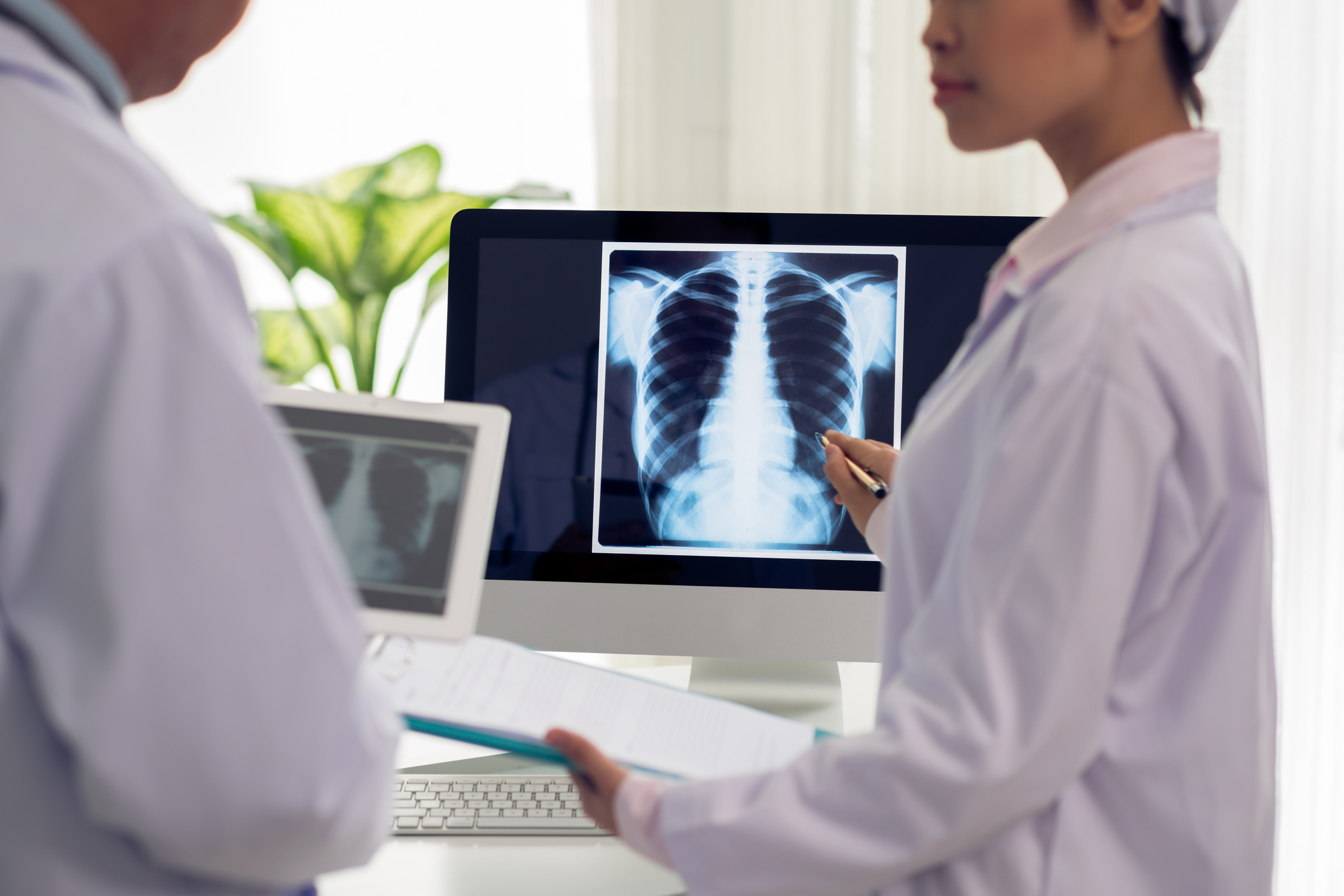 lung x-ray, chest x-ray, lung x ray, chest x ray, lung xray, chest xray