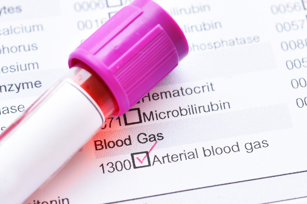 How Does An Arterial Blood Gas ABG Study Work What Does It Test 