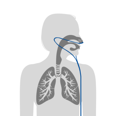 Oxygen flow diagram showing oxygen flowing to the lung